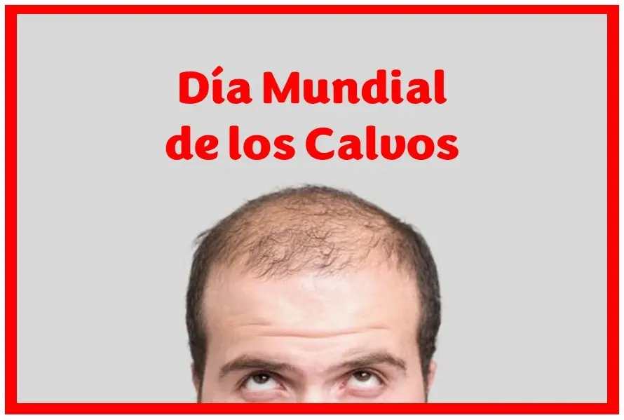 Día Mundial de los Calvos