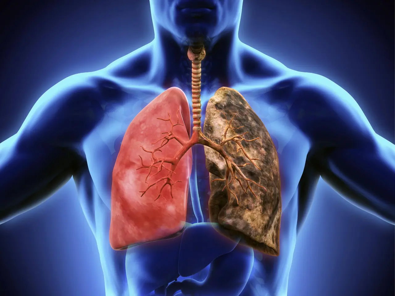 Representación científica de una mutación genética asociada con cáncer de pulmón